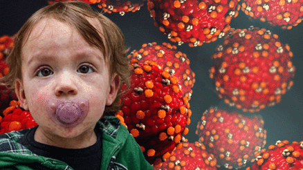 Sessizce yayılıyor Dünyanın çeşitli yerlerinde vakalar ve ölümler artıyor... İşte Türkiye’deki durum Sessizce yayılıyor Dünyanın çeşitli yerlerinde vakalar ve ölümler artıyor... İşte Türkiye’deki durum