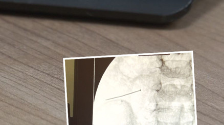 2 yaşındaki çocuk ağrıyla kıvranıyordu... Hastaneye götürülünce bağırsağından çıktı | Ölümle sonuçlanabilirdi 2 yaşındaki çocuk ağrıyla kıvranıyordu... Hastaneye götürülünce bağırsağından çıktı | Ölümle sonuçlanabilirdi