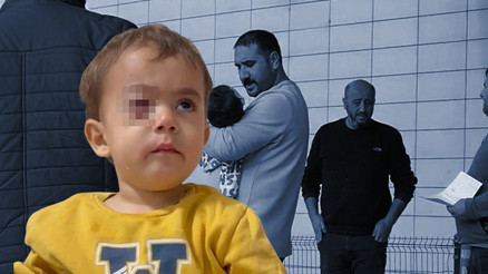 Baba, fırıncıyı daha önce uyarmış 2 yaşındaki Alpaslan gözünü kaybetti