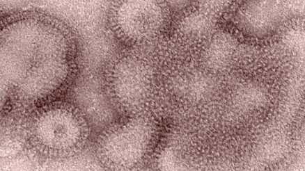 ABDde H3N2 virüsü endişesi: Farklı ülkelerde de görüldü Salgın şiddetli olabilir