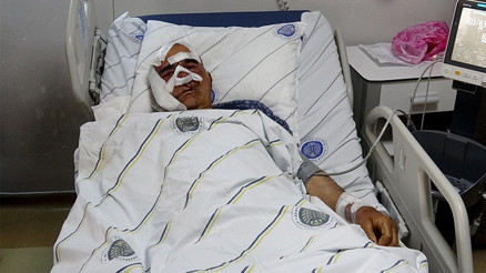 Köyde 5. kez aynı kabus Yaşlı adama saldırdı, pençe darbeleriyle yüzündeki kemiği kopardı