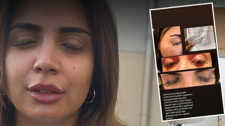 Güzellik merkezinde gözüne yapıştırıcı kaçan genç kadın az kalsın kör olacaktı