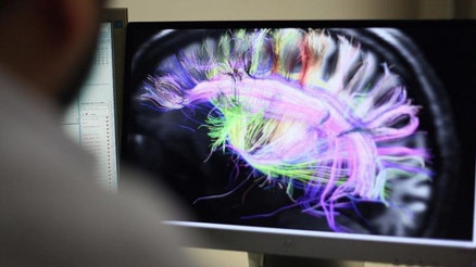 Cambridge Üniversitesinden çarpıcı araştırma: İnsan beyni 5 evreden geçiyor, ergenlik 32 yaşına kadar sürüyor