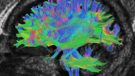 Bu araştırma yaşla ilgili bildiğimiz her şeyi yerle bir etti 32 yaşında ergenlikten çıkıyor, 66’da ise yaşlanmaya başlıyormuşuz