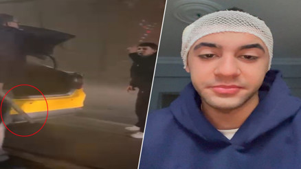 Tartışmaya girdiği taksicisi, motosiklet sürücüsünü sopayla yaraladı