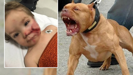 Ankarada pitbull dehşeti: Çocuğun yüzü paramparça oldu