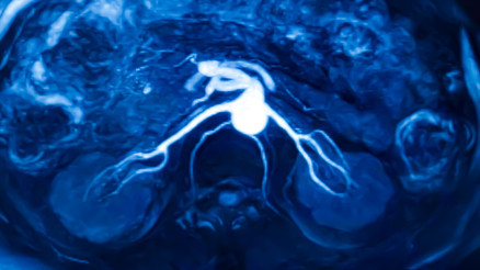 Gizemli kanser artışını araştıran gazeteci 29 yaşında hastalığa yakalandı... ‘Sağlık editörü olmama rağmen bu belirtileri ben bile kaçırdım