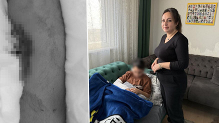 Okulda akran zorbalığı: 9 yaşındaki çocuk arkadaşının kolunu iki yerinden kırdı Öğretmene şikayet ettiği için intikamını aldım