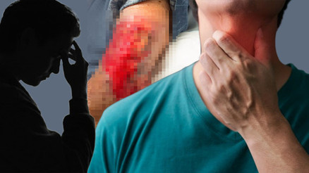 Basit bir boğaz ağrısı kâbusu başlattı: ‘Hayatta olmam bir mucize’ | 25 ameliyat geçirdi... Bu belirtilere dikkat