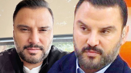 Alişandan botoks açıklaması: Kaşlar düştü sakin olalım