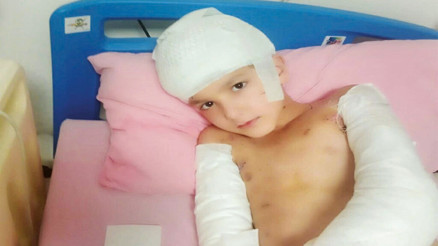 Başıboş köpek dehşetine 5 milyon TL tazminat