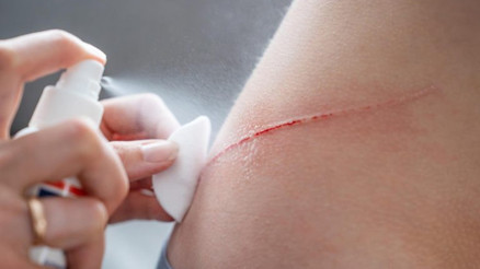 Kanamayı 1 saniyede durduran toz üretildi