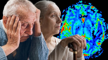 Virüsü atlattınız ama zihniniz tehlikede olabilir Bilim insanlarından korkutan Alzheimer uyarısı | BU BELİRTİLERE DİKKAT