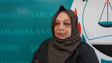 Ankarada kadına şiddete tutuklama Bakan Tunç ve Göktaştan açıklama