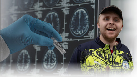 Demansı yaşlılık hastalığı olarak bilirdik… 24 yaşındaki genci nasıl hayattan kopardı Demansı yaşlılık hastalığı olarak bilirdik… 24 yaşındaki genci nasıl hayattan kopardı