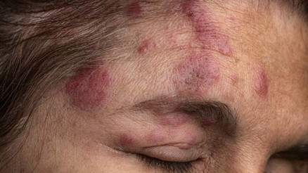 Uzmanlardan kritik uyarı: Vücudunuzdaki virüs her an uyanabilir