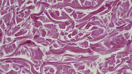 Bilim insanları yaşlı hücreleri gençleştirmenin yolunu bulmuş olabilir