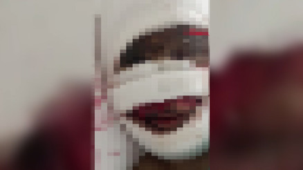Eşinin başından aşağı kezzap döktüğü Sibel, olay anını anlattı