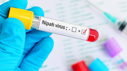 Nipah virüsü nedir, nasıl bulaşır, Türkiyede var mı Hindistan Nipah virüsü belirtileri ve korunma yöntemleri