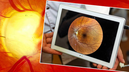 Uzmanlar uyardı: Bu hastalık sandığınızdan çok daha yaygın Sessizce ilerliyor, geç fark ediliyor