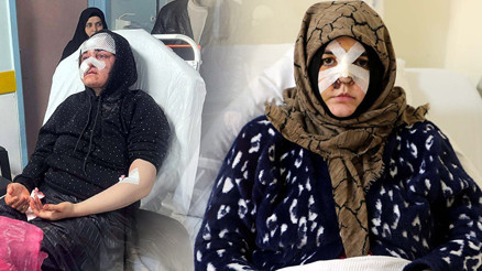 Kaldırım taşı ile saldırdı, Nazlının kabusu oldu | Çıkarsa yarım bıraktığı işi yapacak