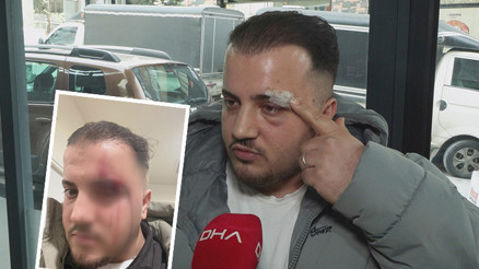 İstanbulda akılalmaz olay Dövdüğü adamı ATMde tanımazlıktan geldi: Buyur kardeşim İstanbulda akılalmaz olay Dövdüğü adamı ATMde tanımazlıktan geldi: Buyur kardeşim