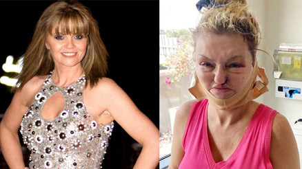 O bebeksi görüntüsü hatıralarda kaldı... Güzelleşme hırsı ünlü oyuncunun yüzünü de parasını da aldı götürdü