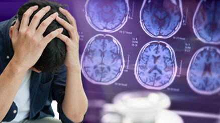 Uzmanlar uyarıyor: Demans ölümleri beklenenden hızlı artıyor Türkiye’de durum ne