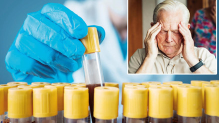 Kan testiyle Alzheimer’a erken teşhis