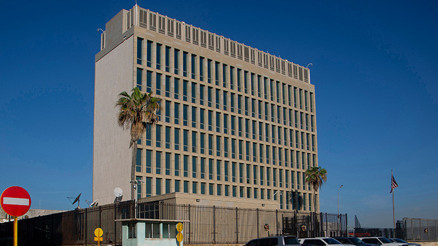 Kendi üzerinde Havana Sendromu deneyi yaptı; Washington’ı alarma geçirdi