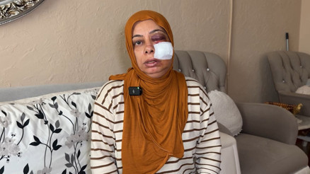 İskenderunda elektrikli bisikleti ile kapağı kırık rögara düştü Ölümden döndüm