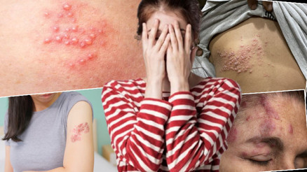 Gençleri hedef alıyor: Ölümcül olabiliyor ‘Derime kaynar su dökülmüş gibiydi’, ‘Eve kapandım, dışarı çıkamadım’