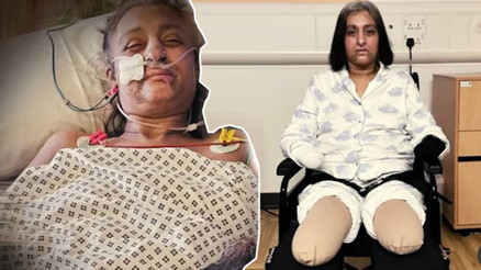 Köpeği yarasını yaladı, elleri ve ayaklarını kaybetti Uzman isim uyardı: Tükürük teması ve ısırıkları sakın görmezden gelmeyin