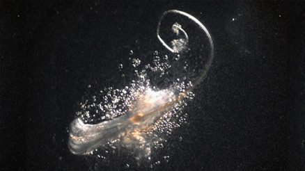 Saç dökülmesinde önemli gelişme: Laboratuvarda gerçek saç folikülleri üretildi