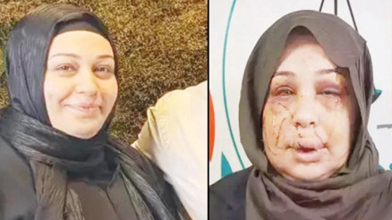 Tırnak makaslı işkenceye 15 yıl