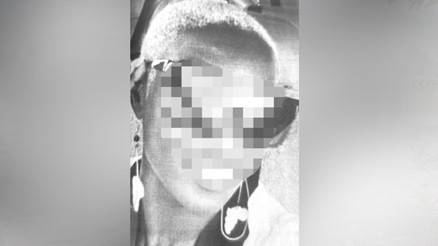 Başarısız saç ekimine 4 milyon liralık dava