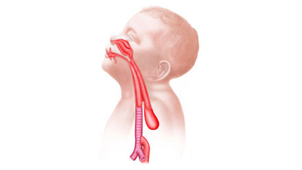 Dünyada bir ilk: Laboratuvarda üretilen yemek borusu, nadir hastalıkla doğan çocuklar için umut oldu