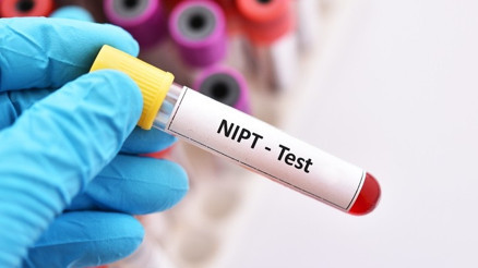 NIPT testi yaygınlaşıyor