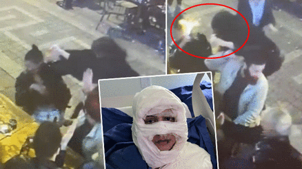 Kadıköydeki dehşet Üzerine kolonya döktüğü kadını yakmıştı... İlk kez hakim karşısına çıktı: Saçlarını yakma isteği doğdu Kadıköydeki dehşet Üzerine kolonya döktüğü kadını yakmıştı... İlk kez hakim karşısına çıktı: Saçlarını yakma isteği doğdu