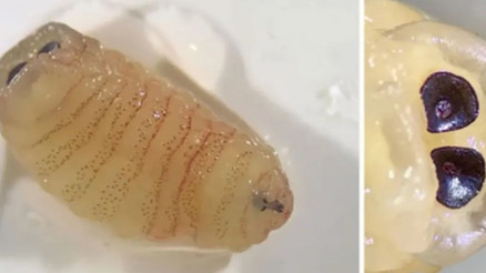 Hapşırınca burnundan çıktı: Yüzüne üşüşen sinekler haftalar sonra dehşete dönüştü