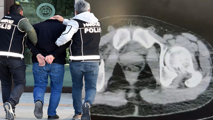 Mide içi uyuşturucu kaçakçılığı: Röntgen çekiminde yakayı ele verdiler