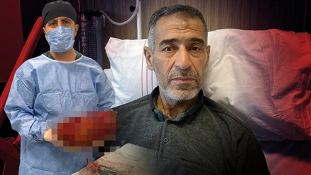 Karın ağrısı ve şişkinlik şikayetiyle hastaneye gitti; 8 kiloluk böbreği ameliyatla alındı