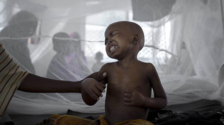 Afrika ülkesinde kolera alarmı: Acil tedbirler devreye alındı