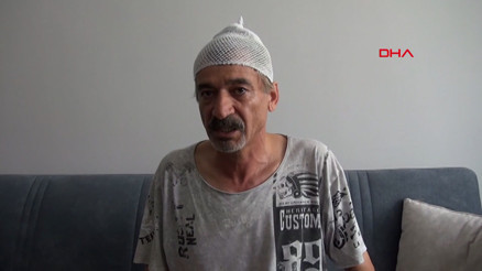 Çay içerken başına beton parçası düştü