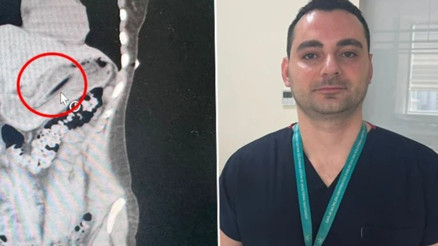 Zayıflamak için kendini kusturmaya çalışırken diş fırçası yuttu