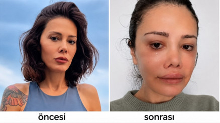 Didem Ceran kimdir, nereli, kaç yaşında Didem Ceran neden yüz nakli oldu