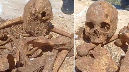Malatyada temel kazısında insan kemikleri ile kafatası parçası bulundu