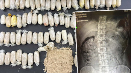 Şüphe üzerine durduruldular: 2 İranlının midesinden uyuşturucu çıktı Şüphe üzerine durduruldular: 2 İranlının midesinden uyuşturucu çıktı