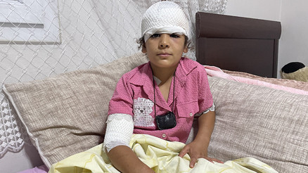 Şanlıurfada başıboş köpek saldırısı 8 yaşındaki Evin kanlar içinde kaldı