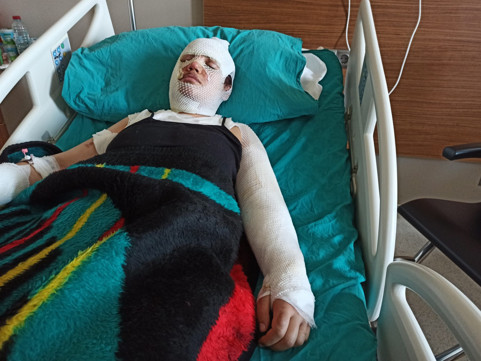 Dehşete düşüren vahşet Depremzede eski eşini kaynar suyla yaktı... İfadesi pes dedirtti: Artçı sarsıntı nedeniyle oldu